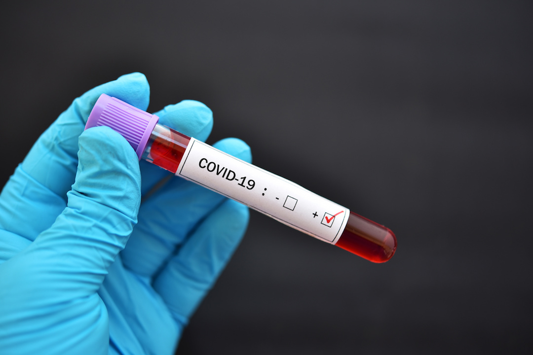 COVID-19 test tube sample