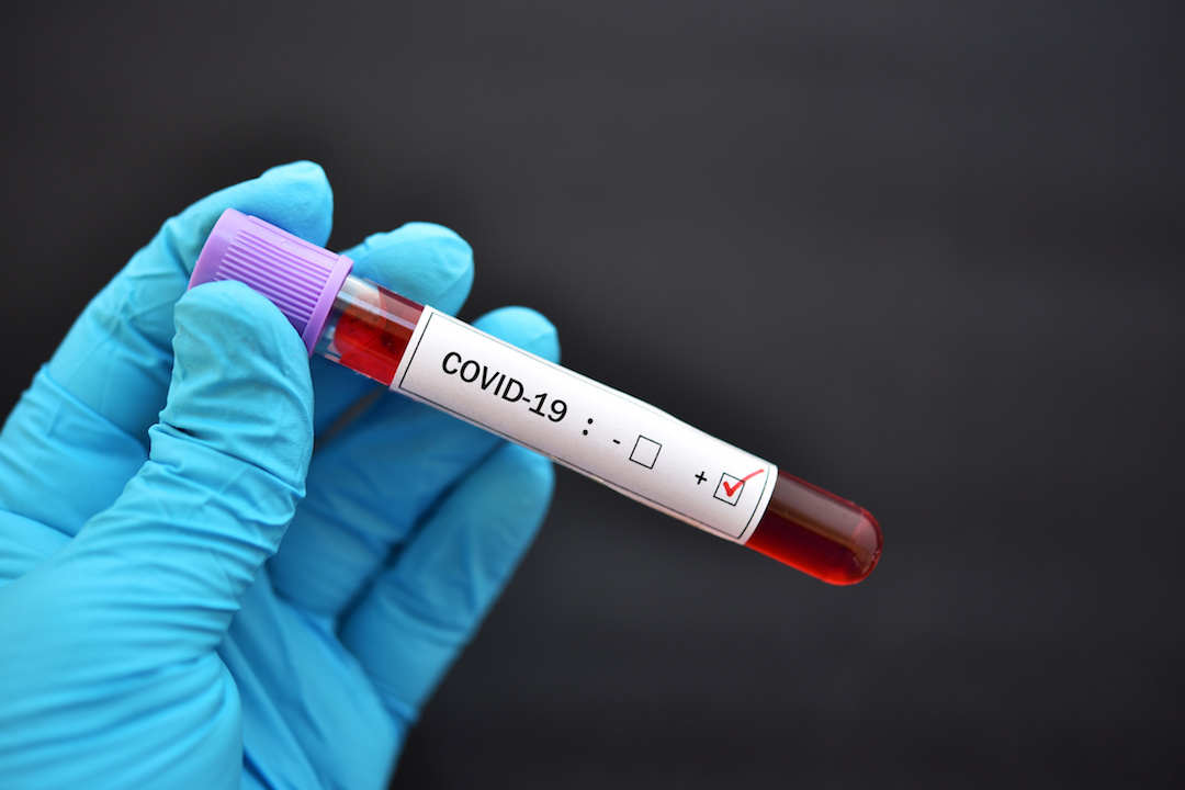 COVID-19 test tube sample